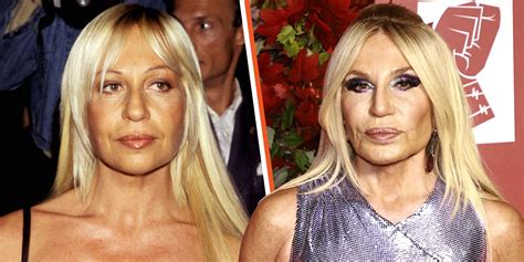 donatella versace before plastic surgery and after|Donatella Versace without plastic surgery.